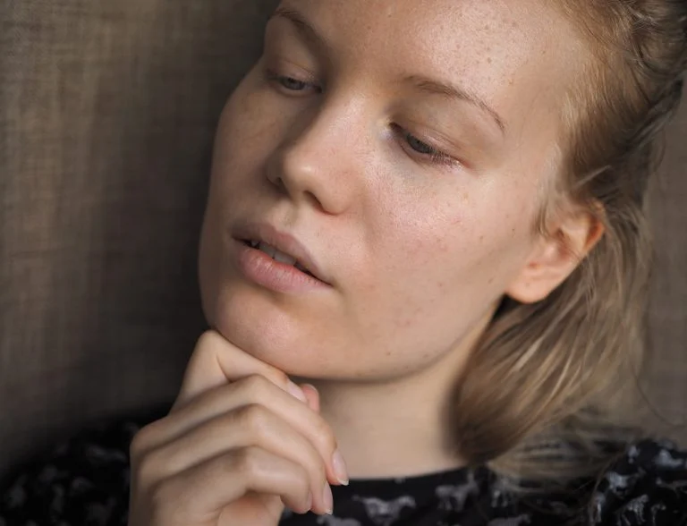 skin after three months of Acnatac gel